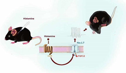 成纖維細胞生長因子FGF13在癢覺中的作用及其機制